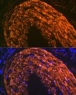 Calponin 1 Antibody in Immunohistochemistry (Paraffin) (IHC (P))