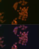 Kaiso Antibody in Immunocytochemistry (ICC/IF)