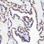 CDCA5 Antibody in Immunohistochemistry (Paraffin) (IHC (P))