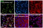 Prolactin Receptor Antibody