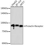 Prolactin Receptor Antibody in Western Blot (WB)