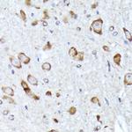 BNIP1 Antibody in Immunohistochemistry (Paraffin) (IHC (P))