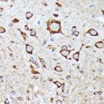 BNIP1 Antibody in Immunohistochemistry (Paraffin) (IHC (P))