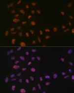 PRP8 Antibody in Immunocytochemistry (ICC/IF)