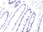 PRP8 Antibody in Immunohistochemistry (Paraffin) (IHC (P))