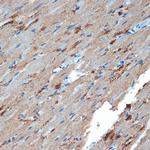 Creatine Kinase BB Antibody in Immunohistochemistry (Paraffin) (IHC (P))