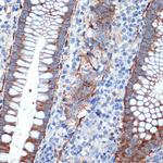 Creatine Kinase BB Antibody in Immunohistochemistry (Paraffin) (IHC (P))