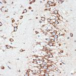 LMAN1 Antibody in Immunohistochemistry (Paraffin) (IHC (P))