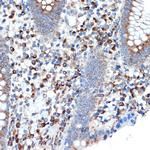 LMAN1 Antibody in Immunohistochemistry (Paraffin) (IHC (P))