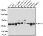 LMAN1 Antibody in Western Blot (WB)