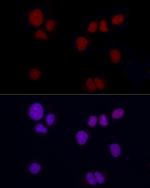 Brachyury Antibody in Immunocytochemistry (ICC/IF)