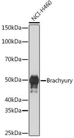 Brachyury Antibody in Western Blot (WB)