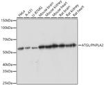 ATGL Antibody in Western Blot (WB)