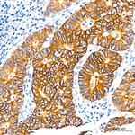 CDH17 Antibody in Immunohistochemistry (Paraffin) (IHC (P))