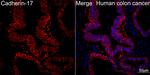 CDH17 Antibody in Immunohistochemistry (Paraffin) (IHC (P))