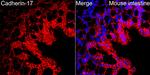 CDH17 Antibody in Immunohistochemistry (Paraffin) (IHC (P))