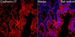 CDH17 Antibody in Immunohistochemistry (Paraffin) (IHC (P))