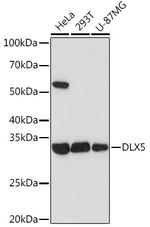 DLX5 Antibody in Western Blot (WB)