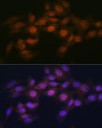 WAPL Antibody in Immunocytochemistry (ICC/IF)