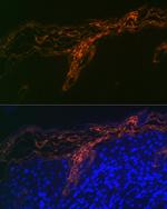 PERP Antibody in Immunocytochemistry (ICC/IF)