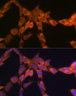 RPSA Antibody in Immunocytochemistry (ICC/IF)