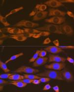 KARS Antibody in Immunocytochemistry (ICC/IF)