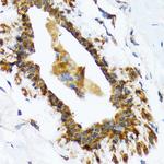 RAIDD Antibody in Immunohistochemistry (Paraffin) (IHC (P))