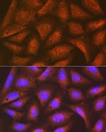 eIF2b epsilon Antibody in Immunocytochemistry (ICC/IF)