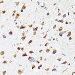 eIF2b epsilon Antibody in Immunohistochemistry (Paraffin) (IHC (P))