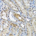 eIF2b epsilon Antibody in Immunohistochemistry (Paraffin) (IHC (P))