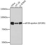 eIF2b epsilon Antibody in Western Blot (WB)