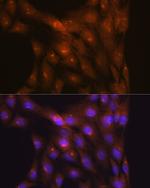 NDUFS4 Antibody in Immunocytochemistry (ICC/IF)