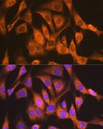 NDUFS4 Antibody in Immunocytochemistry (ICC/IF)