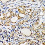 NDUFS4 Antibody in Immunohistochemistry (Paraffin) (IHC (P))