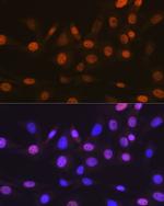 TRBP Antibody in Immunocytochemistry (ICC/IF)