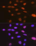 TRBP Antibody in Immunocytochemistry (ICC/IF)