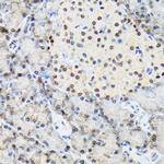 TRBP Antibody in Immunohistochemistry (Paraffin) (IHC (P))