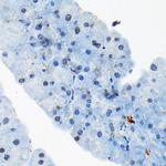 TRBP Antibody in Immunohistochemistry (Paraffin) (IHC (P))