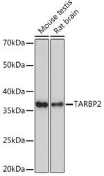 TRBP Antibody in Western Blot (WB)