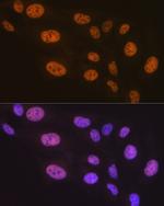 PTBP2 Antibody in Immunocytochemistry (ICC/IF)