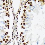 PTBP2 Antibody in Immunohistochemistry (Paraffin) (IHC (P))