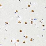 PTBP2 Antibody in Immunohistochemistry (Paraffin) (IHC (P))