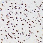 PTBP2 Antibody in Immunohistochemistry (Paraffin) (IHC (P))