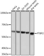 PTBP2 Antibody in Western Blot (WB)