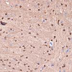 Carbonic Anhydrase II Antibody in Immunohistochemistry (Paraffin) (IHC (P))