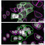 CK1 alpha Antibody in Immunocytochemistry (ICC/IF)