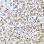 CK1 alpha Antibody in Immunohistochemistry (Paraffin) (IHC (P))