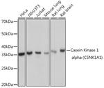 CK1 alpha Antibody in Western Blot (WB)