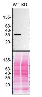 CK1 alpha Antibody in Western Blot (WB)