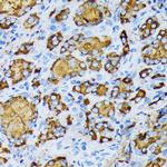 gamma Tubulin Antibody in Immunohistochemistry (Paraffin) (IHC (P))